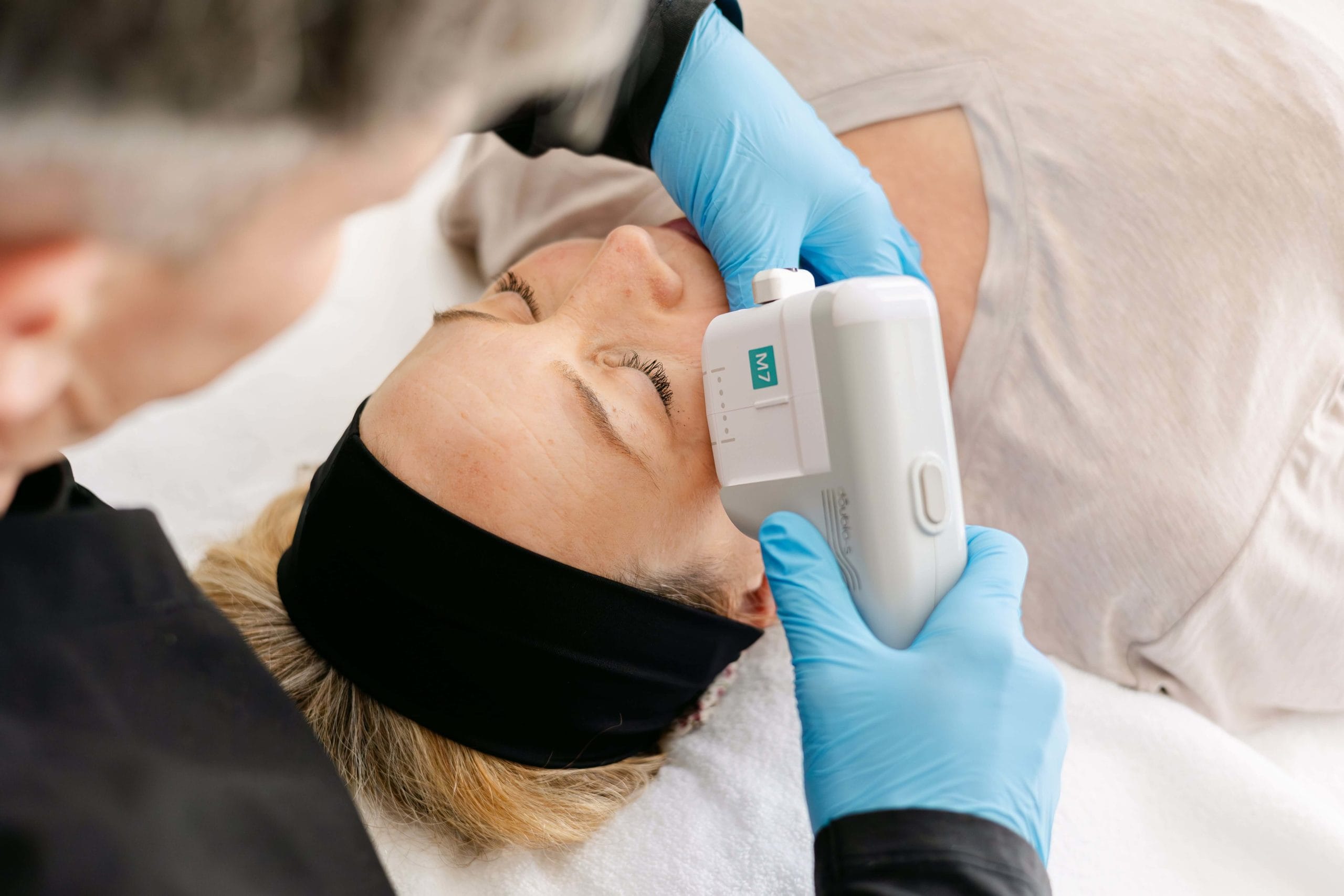 HIFU Wirral Facials, a non surgical treatment.